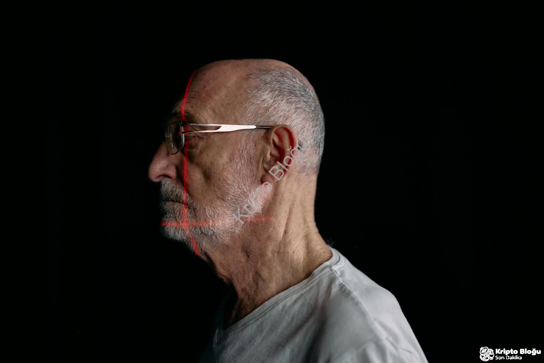 Nişantaşı'nda Lazer Epilasyon Uygulamaları